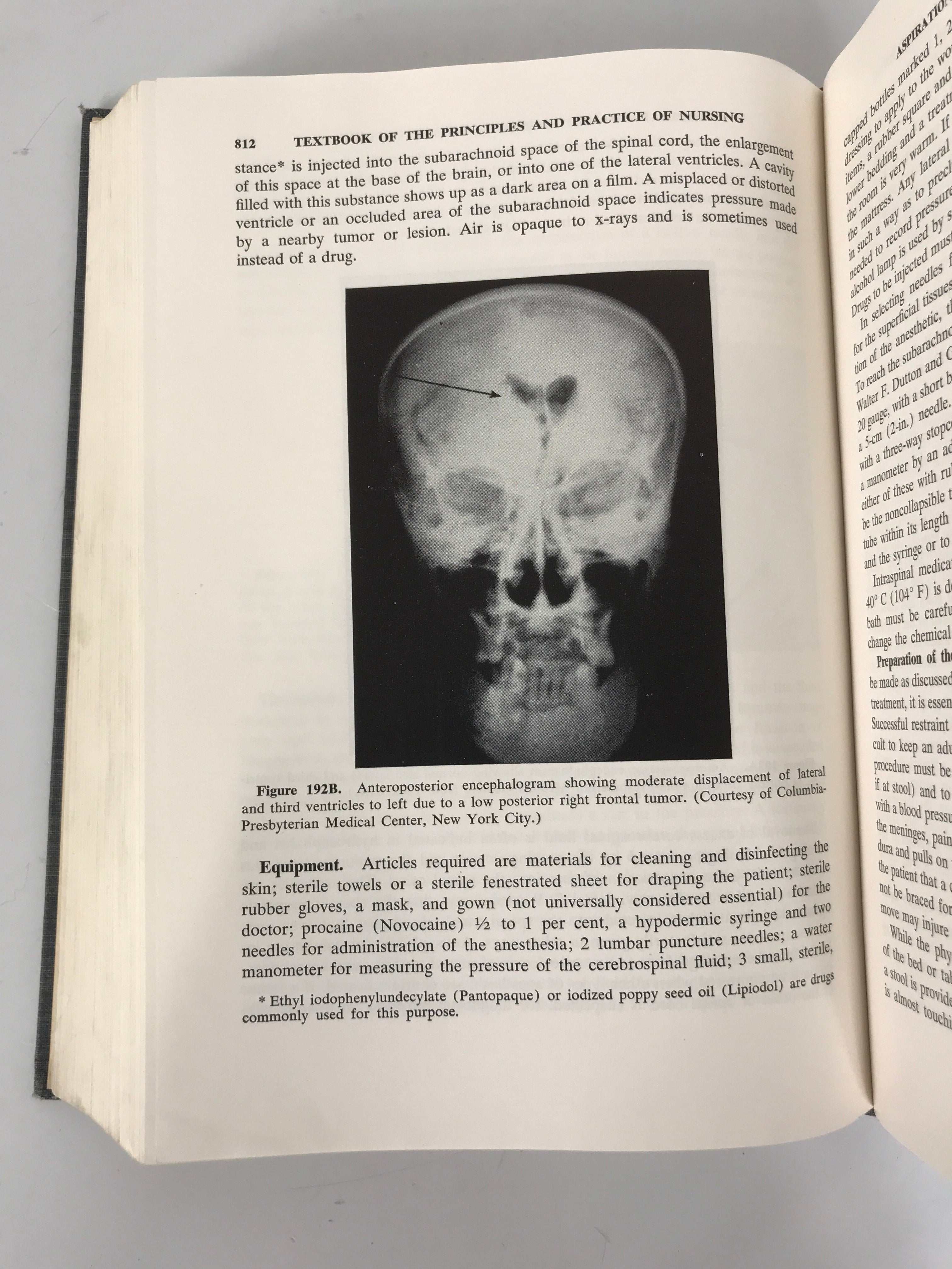 Bundle of 2 Nursing Textbooks: 1955-1956 Editions